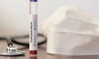 Coronavirus patients around the world rushing to join studies of an experimental drug against some similar viruses